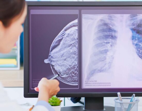 Doctor discussing breast cancer treatment options with patient