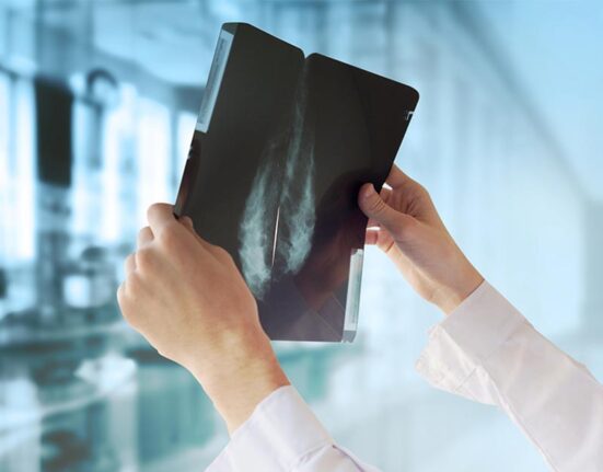 apa itu mamografi? pemeriksaan mamografi untuk deteksi kanker payudara sejak dini