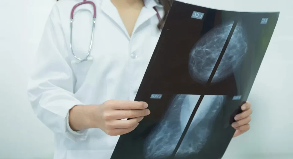 biaya mammografi - Health365