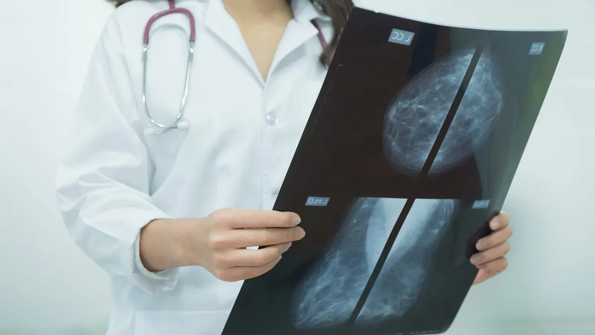 biaya mammografi - Health365