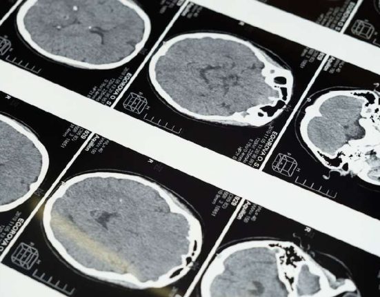 Besaran Biaya MRI di Malaysia dan Rekomendasi Rujukannya