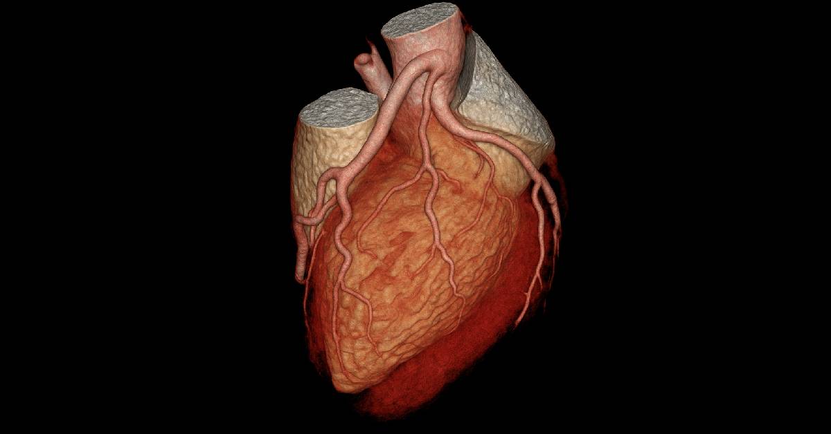 CT Angiografi Jantung & Koroner - Tujuan, Prosedur, hingga Kelebihannya