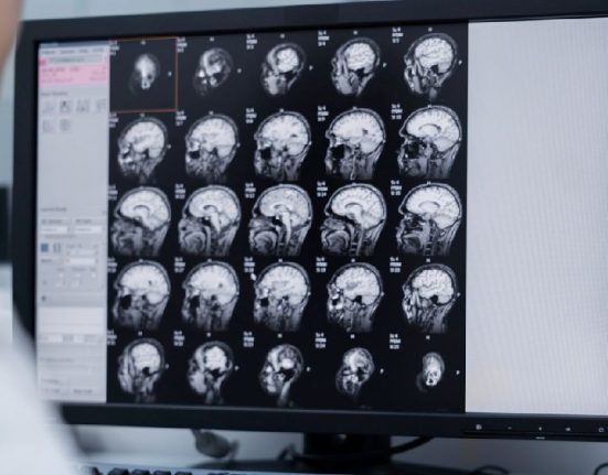 CT Scan Kepala - Jenis, Peruntukkan, hingga Prosesnya