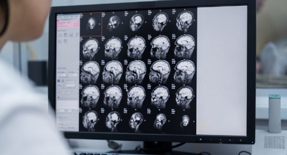 CT Scan Kepala - Jenis, Peruntukkan, hingga Prosesnya