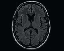 MRI Kepala/Otak
