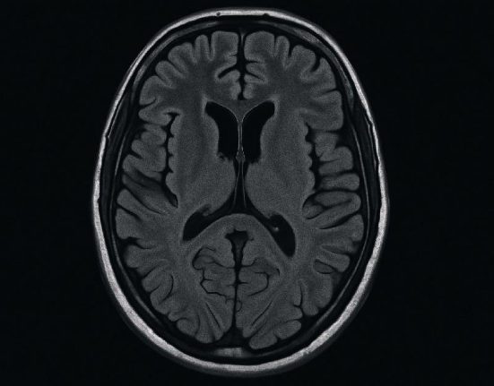 MRI Kepala/Otak