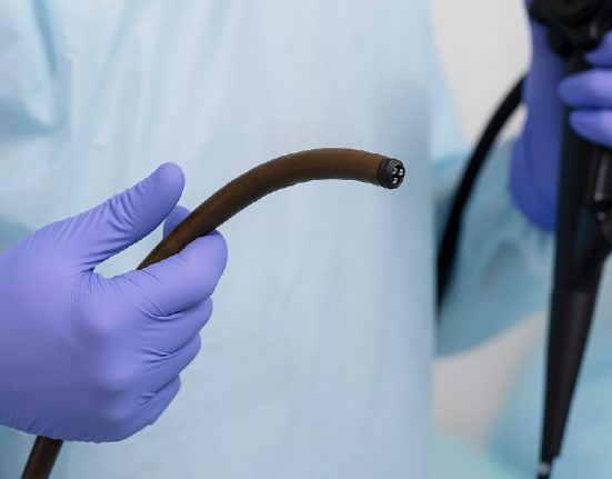 Mengenal Perbedaan Kolonoskopi dan Endoskopi