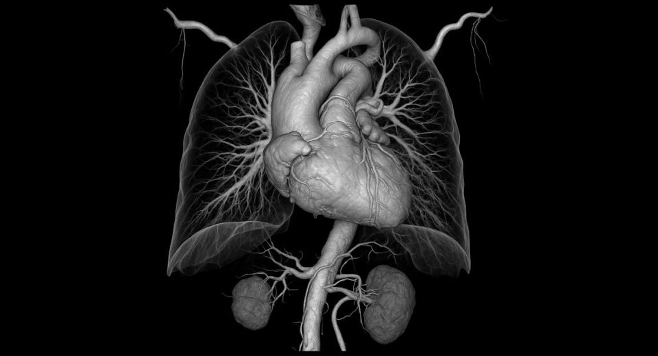 Panduan Lengkap CT Angiografi Dari Prosedur hingga Keunggulannya