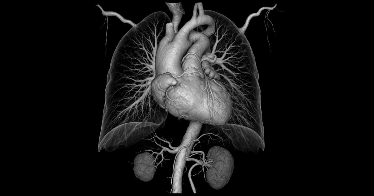 Panduan Lengkap CT Angiografi Dari Prosedur hingga Keunggulannya