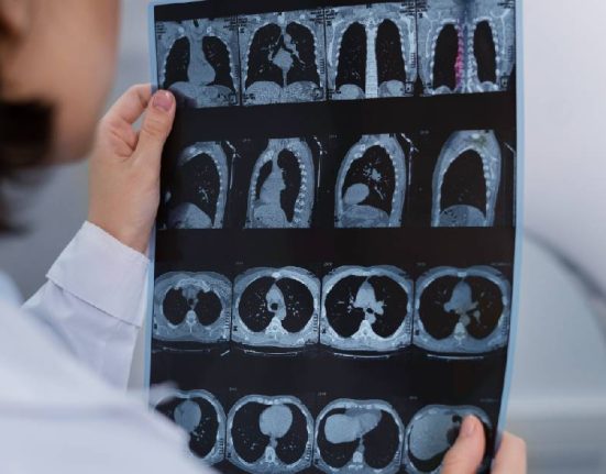 Perbandingan CT, MRI, dan PET Scan yang Perlu Diperhatikan