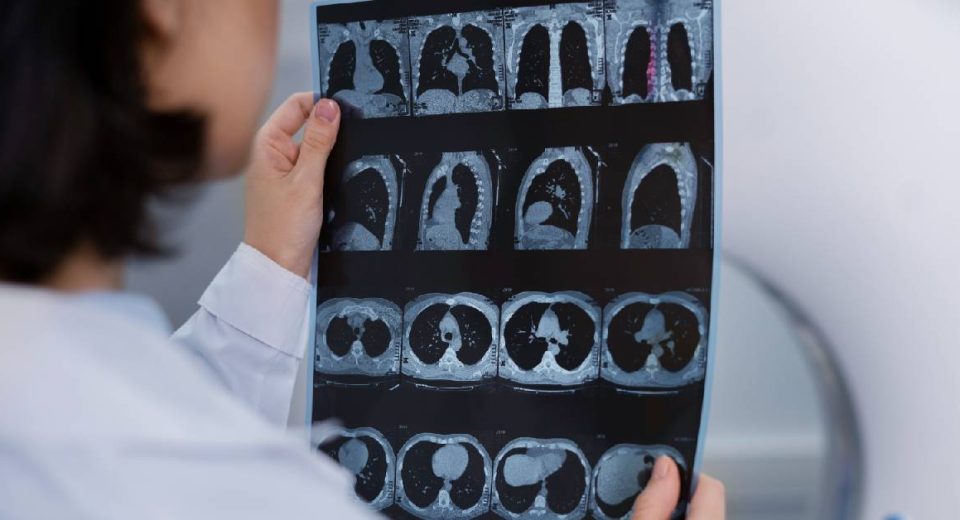 Perbandingan CT, MRI, dan PET Scan yang Perlu Diperhatikan