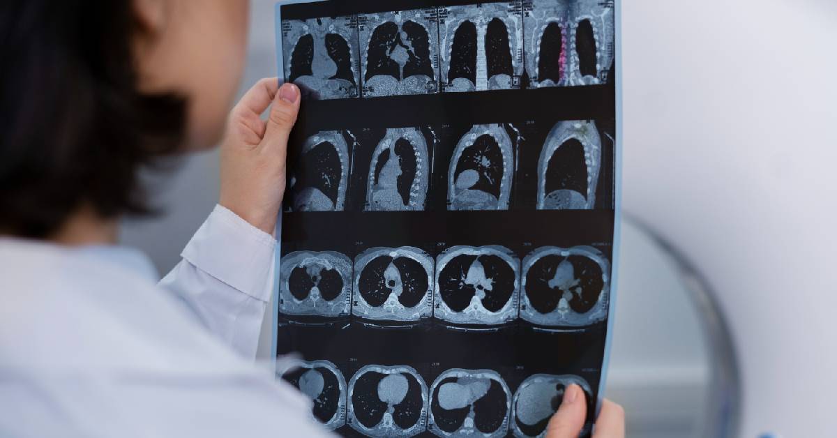 Perbandingan CT, MRI, dan PET Scan yang Perlu Diperhatikan