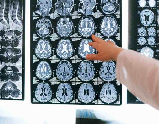 Rincian Biaya MRI di Singapura