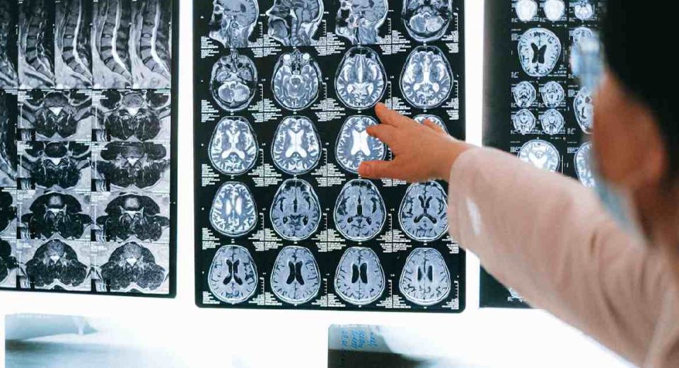 Rincian Biaya MRI di Singapura