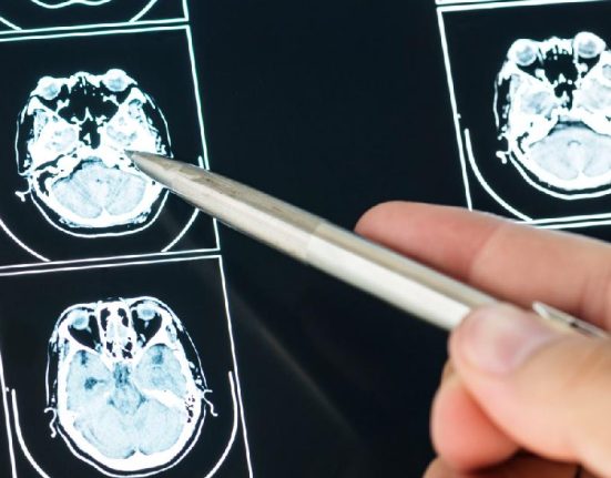 Rincian Estimasi Biaya MRI untuk Pemeriksaan Per-area Tubuh