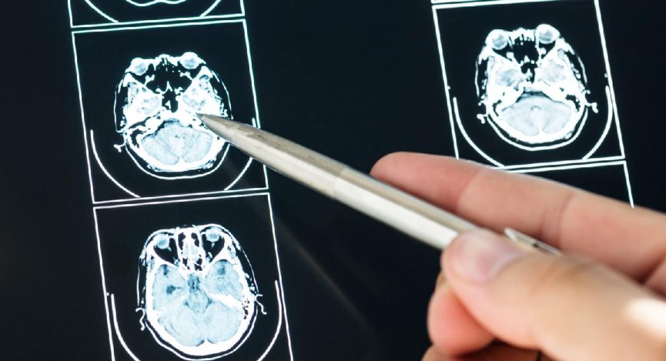 Rincian Estimasi Biaya MRI untuk Pemeriksaan Per-area Tubuh
