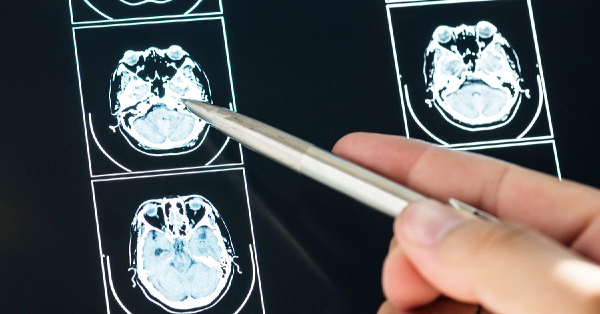 Rincian Estimasi Biaya MRI untuk Pemeriksaan Per-area Tubuh