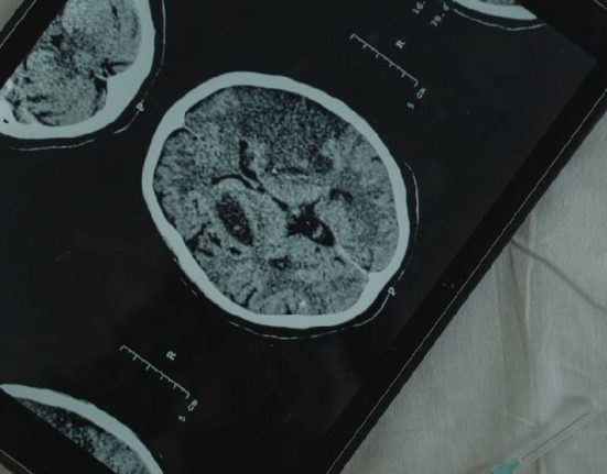 Apakah CT Scan Ditanggung BPJS, Ini Syarat dan Prosedur Pengajuannya