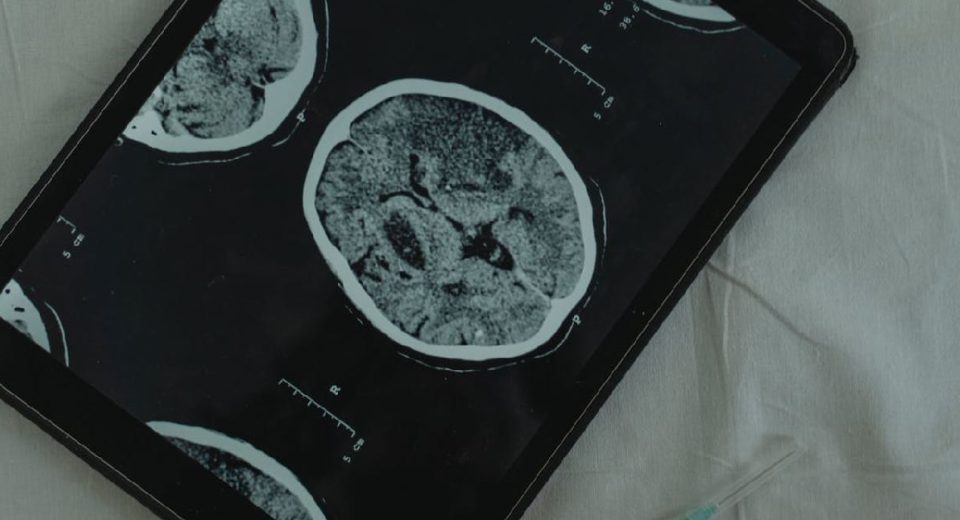 Apakah CT Scan Ditanggung BPJS, Ini Syarat dan Prosedur Pengajuannya