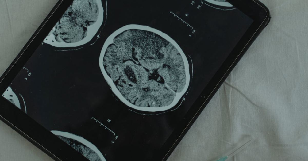 Apakah CT Scan Ditanggung BPJS, Ini Syarat dan Prosedur Pengajuannya
