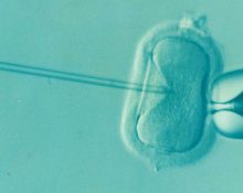 Biaya Program IVF atau Bayi Tabung di Singapura