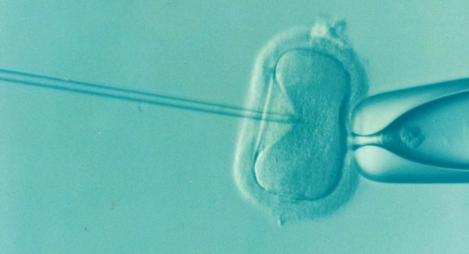Biaya Program IVF atau Bayi Tabung di Singapura