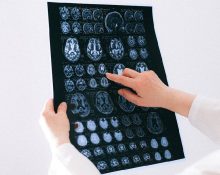 Bisakah MRI Membedakan Kista dan Tumor, Ini Caranya!