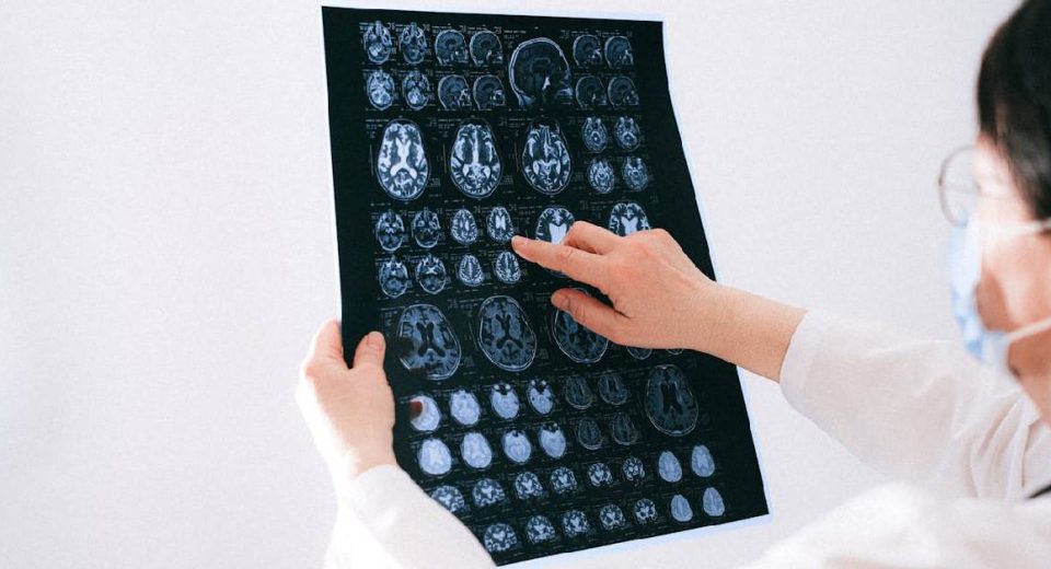 Bisakah MRI Membedakan Kista dan Tumor, Ini Caranya!