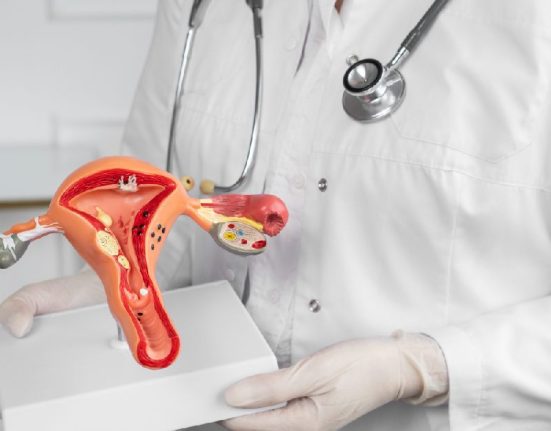 Panduan Cara Diagnosis Sindrom Polikistik Ovarium (PCOS)