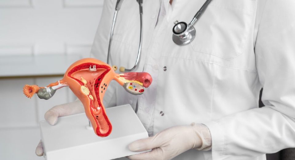 Panduan Cara Diagnosis Sindrom Polikistik Ovarium (PCOS)