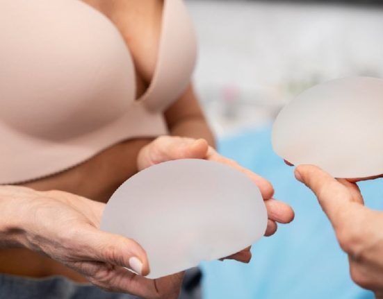 Panduan Prosedur Breast Augmentation atau Pembesaran Payudara untuk Hasil Natural
