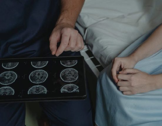 Perbedaan CT Scan Stroke Iskemik dan Hemoragik