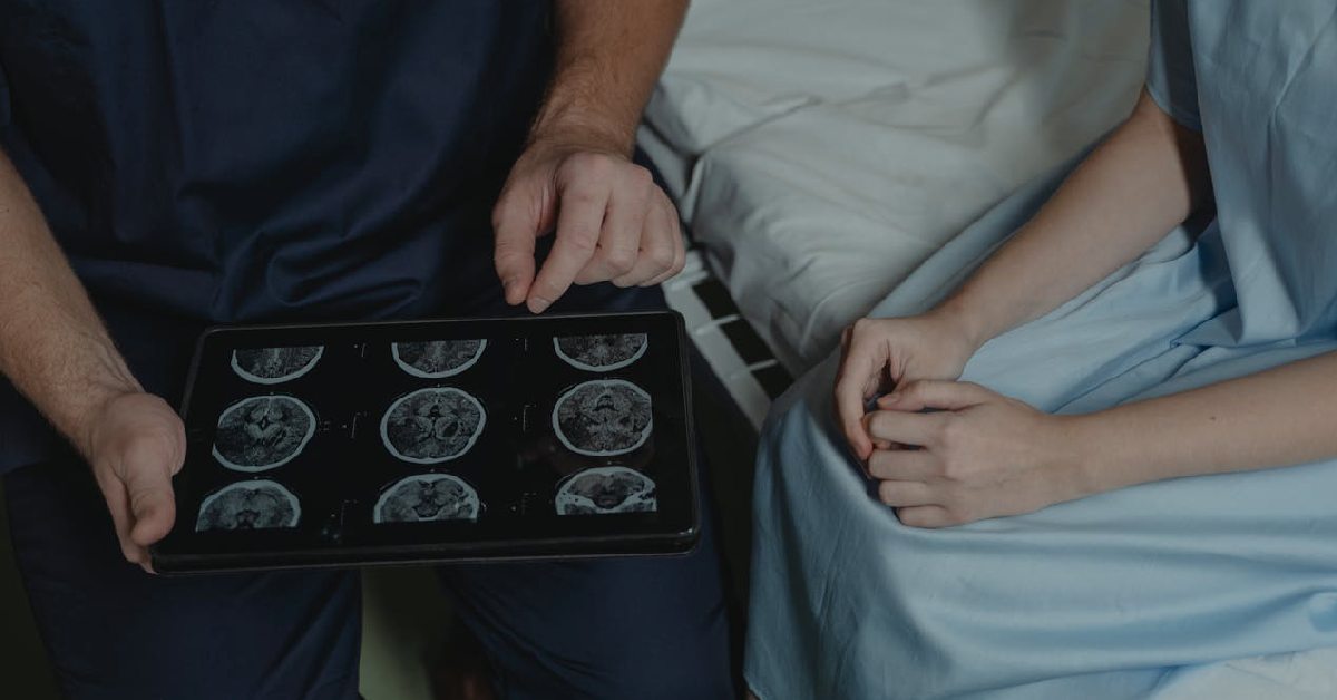 Perbedaan CT Scan Stroke Iskemik dan Hemoragik