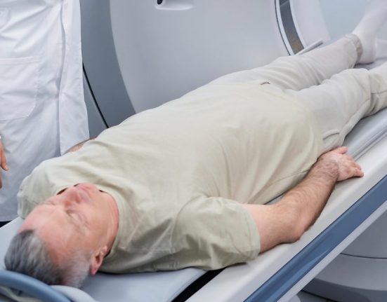 CT Angiogram di Lifescan Medical & Wellness Singapura