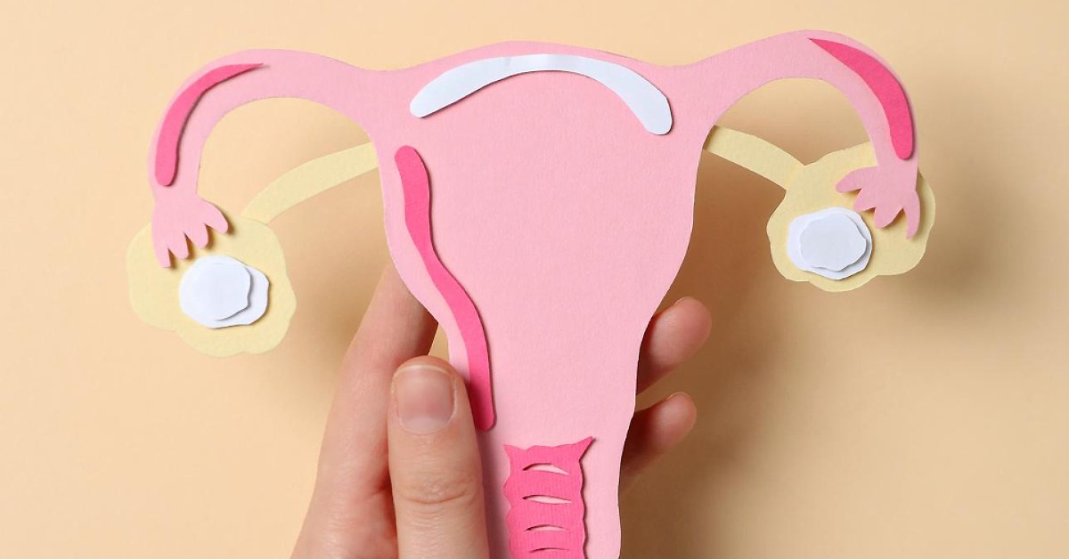 Ini Opsi Pengobatan Endometriosis yang Bisa Dipertimbangkan