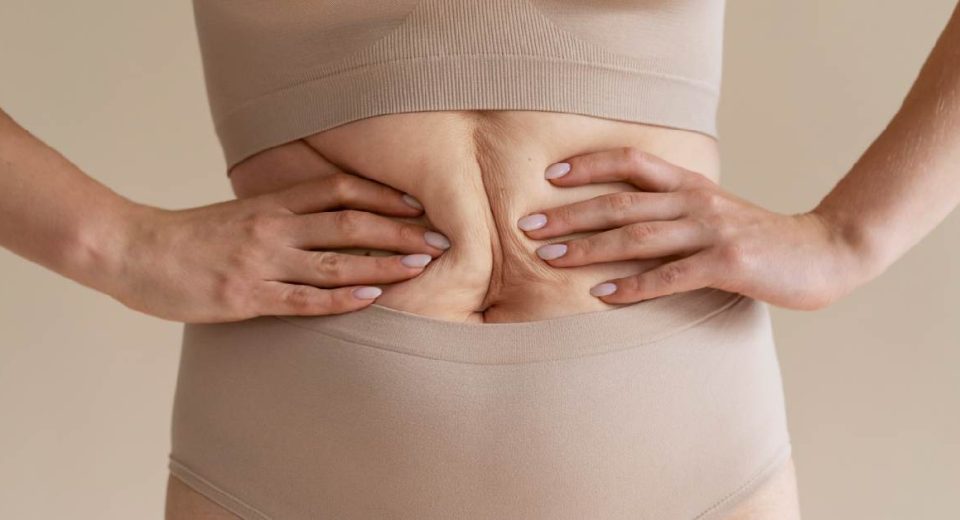Ini Perhitungan Biaya Tummy Tuck di Indonesia
