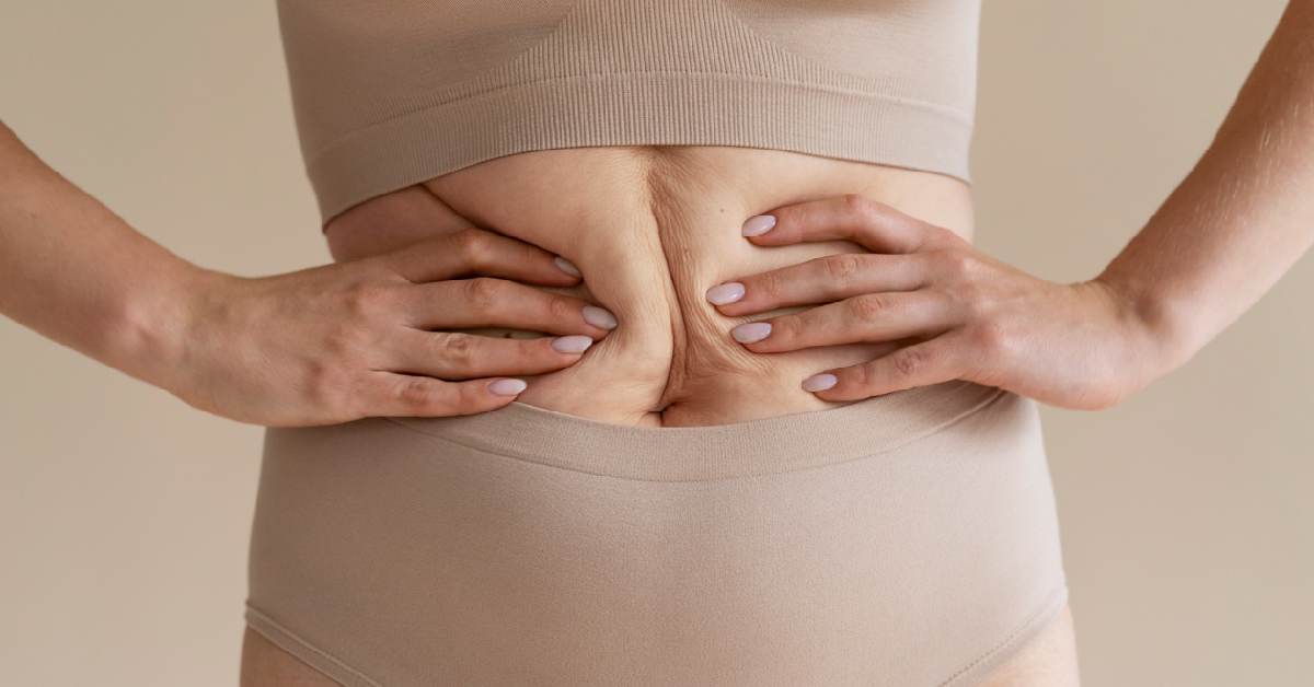 Ini Perhitungan Biaya Tummy Tuck di Indonesia
