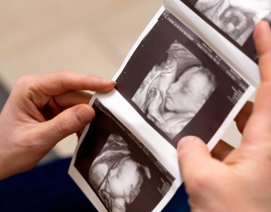 Ini Tahapan Prosedur Bayi Tabung dari Awal hingga Akhir