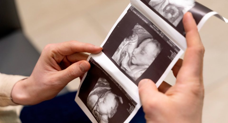 Ini Tahapan Prosedur Bayi Tabung dari Awal hingga Akhir