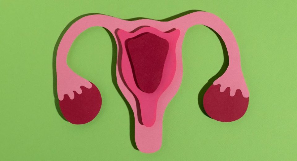 Operasi Laparoskopi untuk Endometriosis