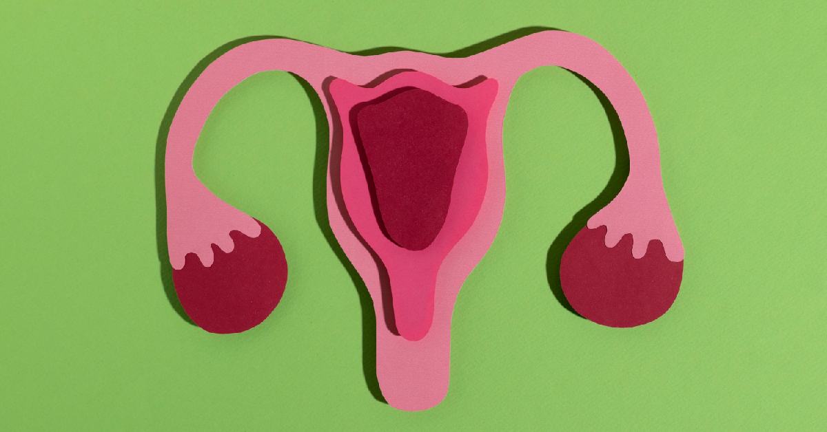 Operasi Laparoskopi untuk Endometriosis