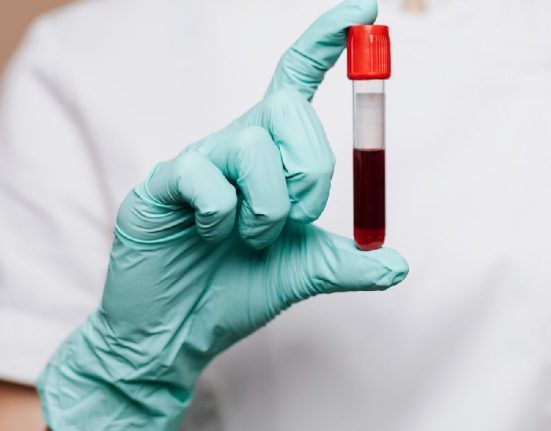 Panduan Skrining Kanker dengan Biopsi Cair di Singapura