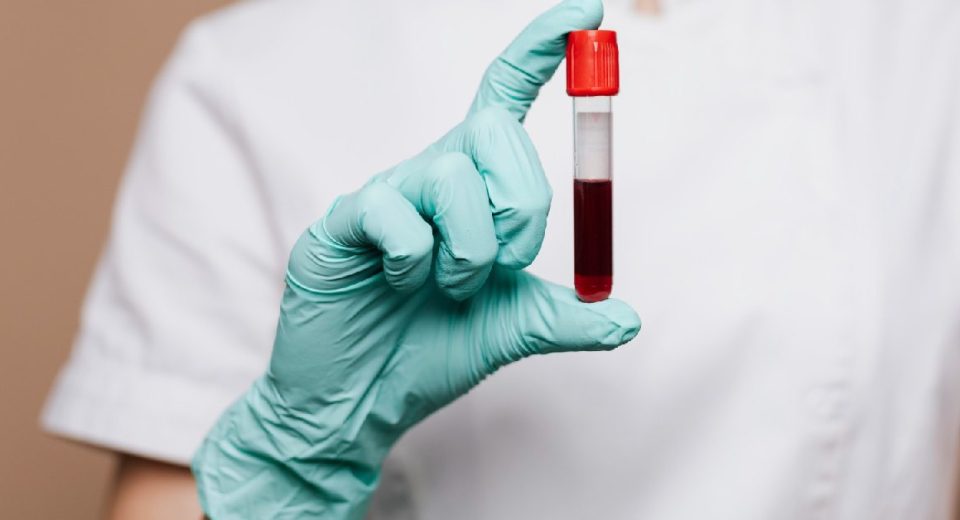 Panduan Skrining Kanker dengan Biopsi Cair di Singapura