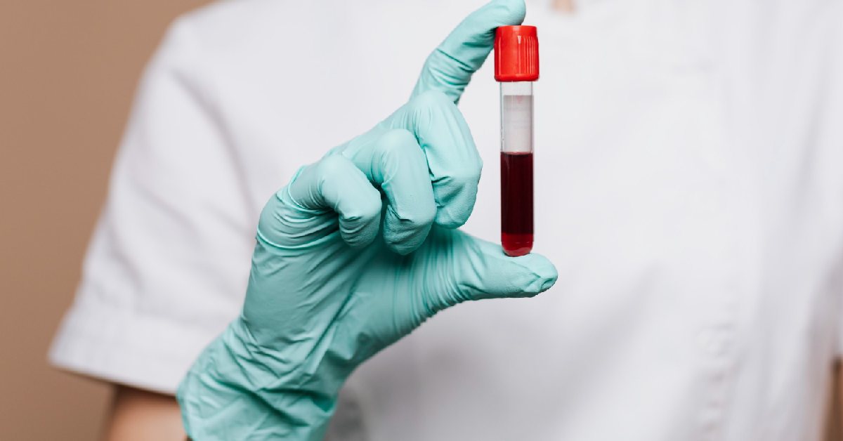 Panduan Skrining Kanker dengan Biopsi Cair di Singapura