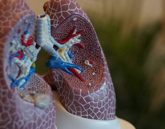 Pentingnya Low Dose CT Scan untuk Kanker Paru-paru dan Mengapa Rontgen Dada Tidak Cukup untuk Skrining Kanker