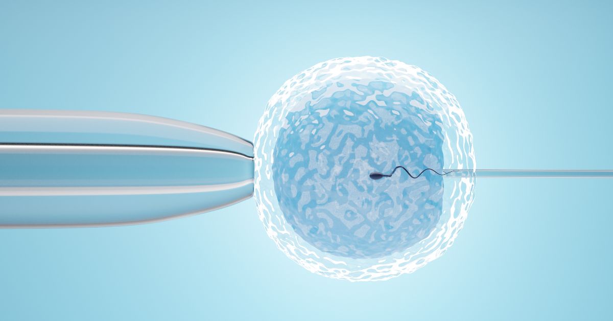 Perbedaan ICSI dan IVF (Bayi Tabung)