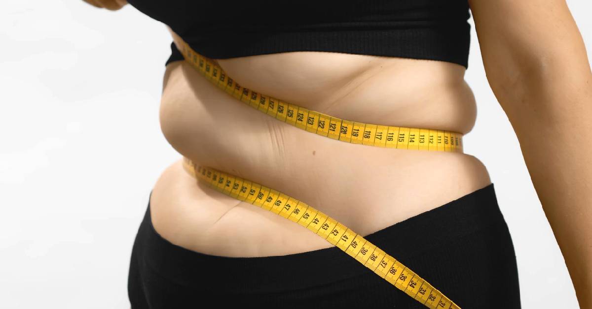 Perbedaan Liposuction dan Tummy Tuck yang Perlu Diketahui