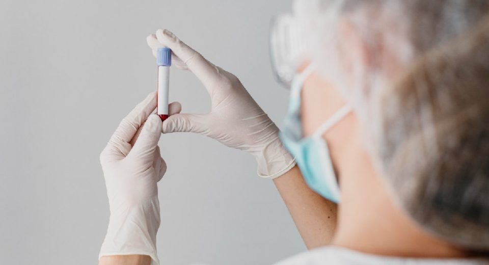 Tes Tumor Marker - Panduan Tepat untuk Deteksi Dini Kanker
