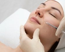 Thread Lift atau Tanam Benang
