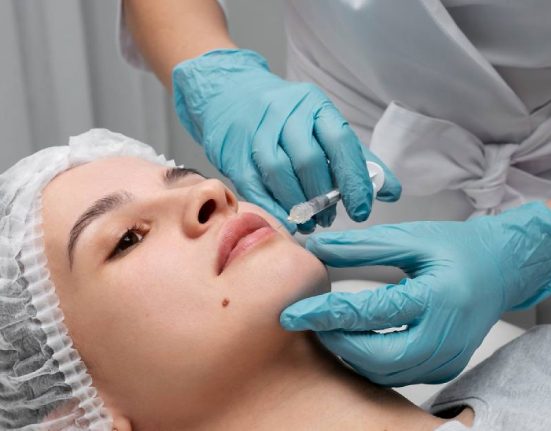 Apa Itu Filler Juvederm